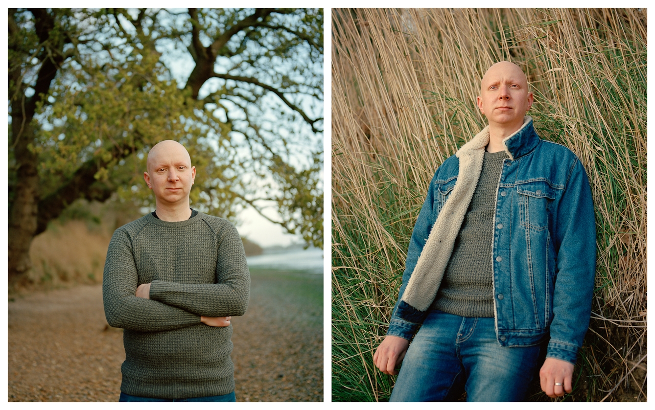 Photographic portrait of a man with alopecia universalis presented as a diptych. The image on the left shows the man stood in a parkland scene, arms crossed looking straight to camera. The image on the right shows the man surrounded by long grass, gazing into the distance.