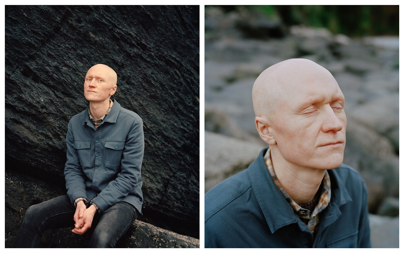 Photographic portrait of a man with alopecia universalis presented as a diptych. The image on the left shows the man looking to camera, sat on a rocky outcrop. The image on the right is closer in on his head and he has his eyes closed.