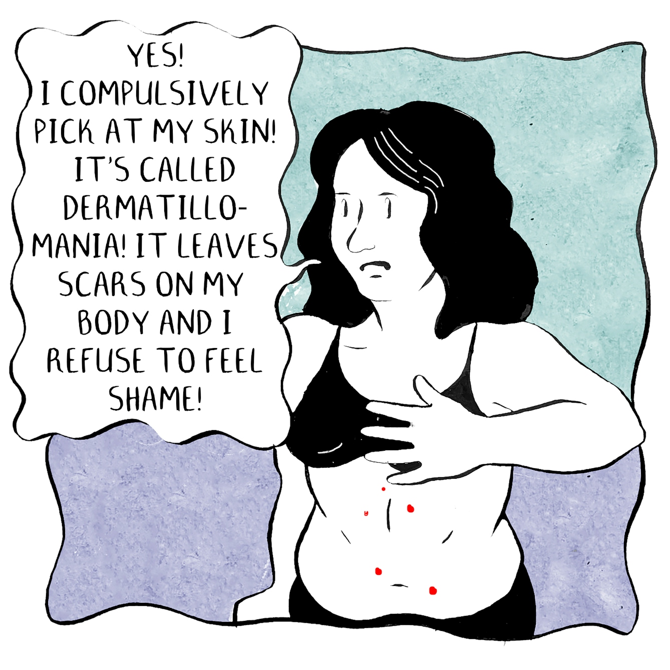 In panel 3 the person with red picked spots on their torso holds their hand to their chest and replies, "Yes! I compulsively pick at my skin! It's called Dermatillomania! It leaves scars on my bodies and I refuse to feel shame!"