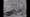 Image of women lying on their backs in a line. A man wearing a doctor's coat sits nearby, looking at them.