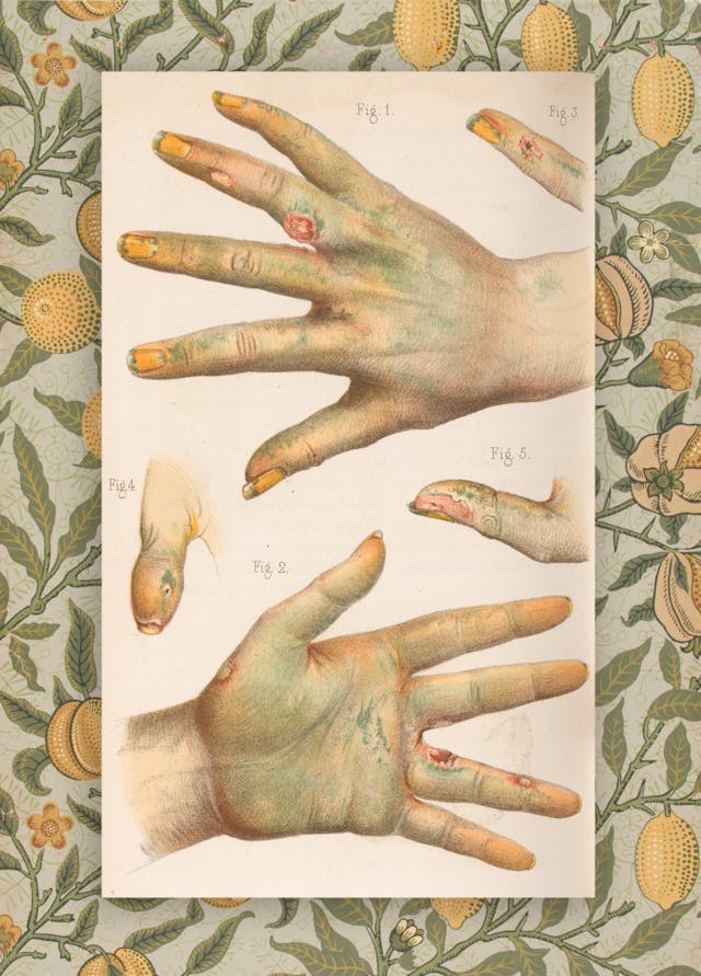 Toxic trends Collection