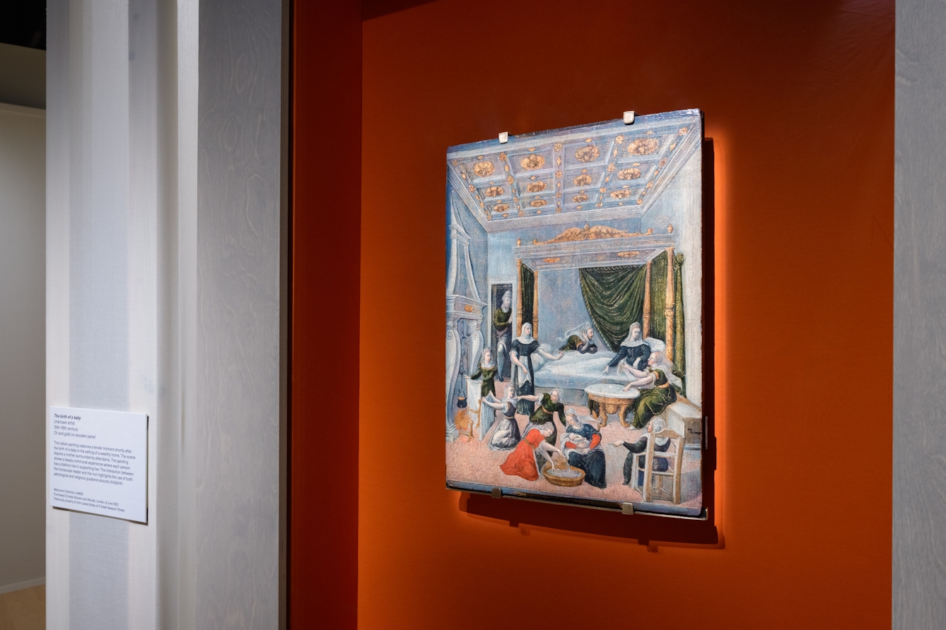 A photograph of an oil painting of a birth, viewed behind glass and with an orange background.