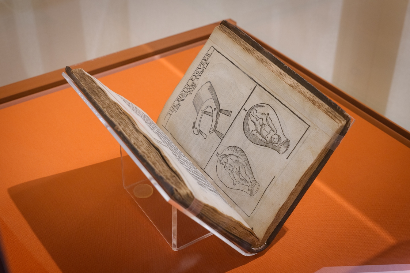 A manuscript in a display case, housed with supports. A line drawn illustration is visible on the open page.