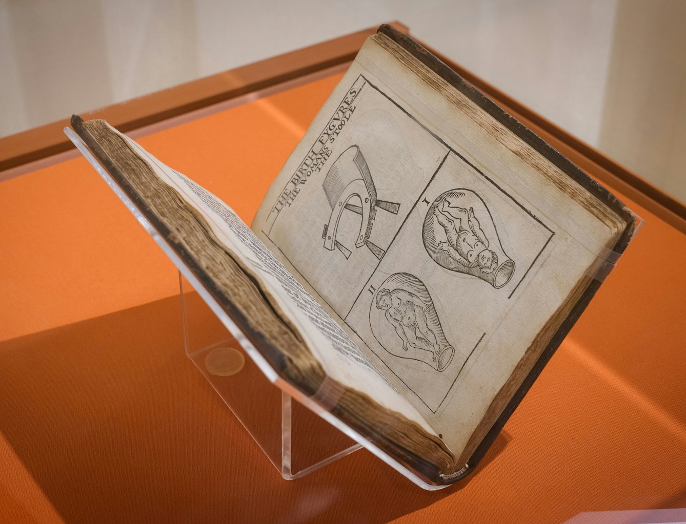 A 16th-century printed book open on display in an exhibition. The open page shows simple illustrations of a foetus in the womb.