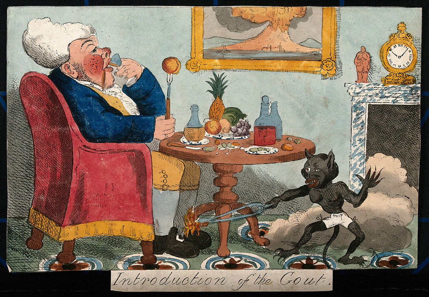 Mis)representations of gout | Wellcome Collection