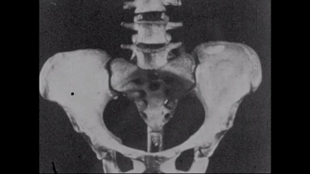 X-ray of the pelvis bones