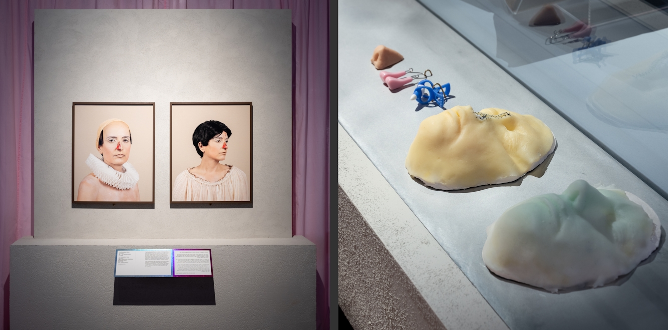 Photographic diptych. The image on the left shows 2 framed photographic portraits of a woman with anatomical painting on her nose to simulate the tissue and structure beneath. The image on the right shows an open display with 2 silicone masks and other prosthetics used in nasal surgery.