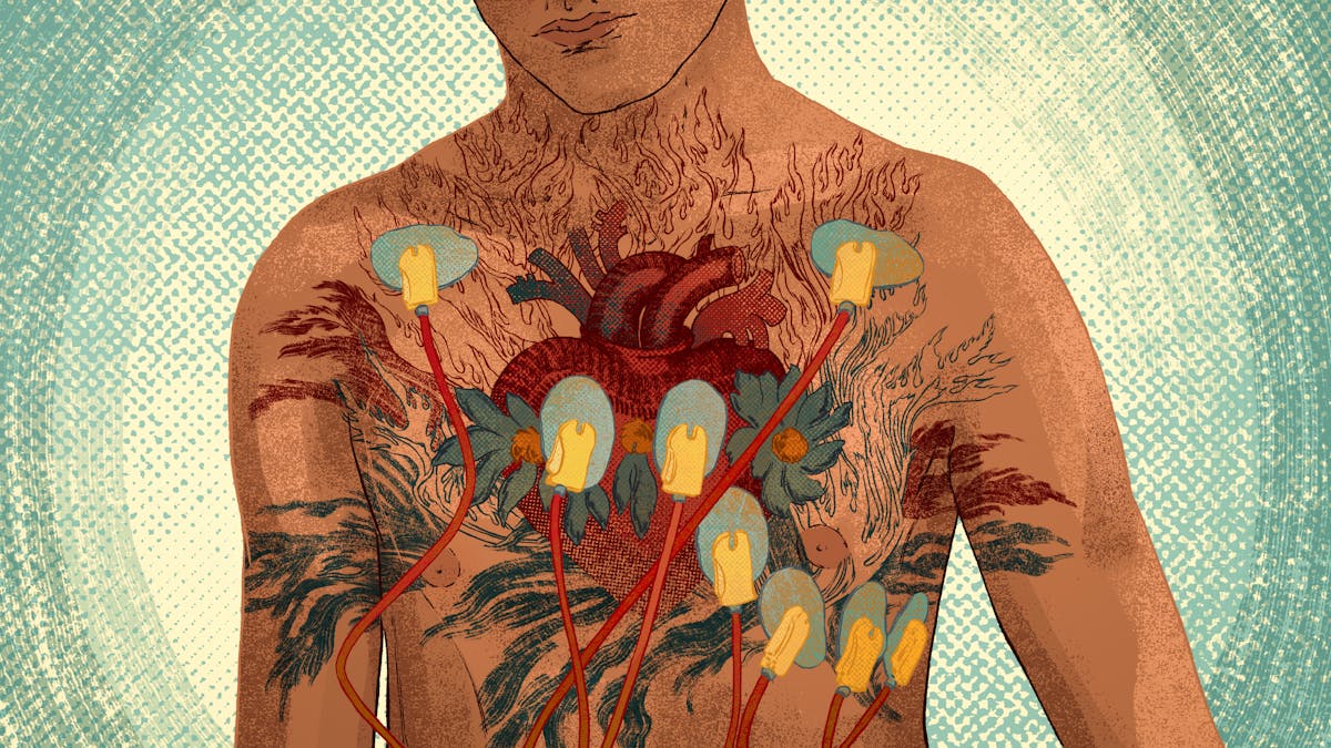 Digital colour artwork showing the bare chest, neck and chin of a man. On his chest is a colourful tattoo-like illustration of an anatomical drawing of a human heart set in flame-like decorative motifs. The tattoo is made up of red and blue tones. Attached to his chest, on top of the tattoo, are eight EGC heart monitoring electrodes with cables. Behind the figure is an abstract concentric circle and half-tone printed background pattern in yellows and blues.