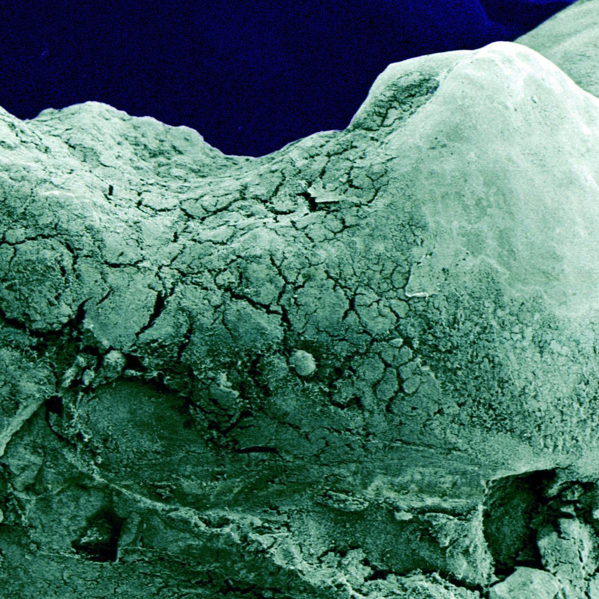 Colour photograph of a tooth, taken using a scanning electron microscope, showing the rough texture of the surface of the tooth.