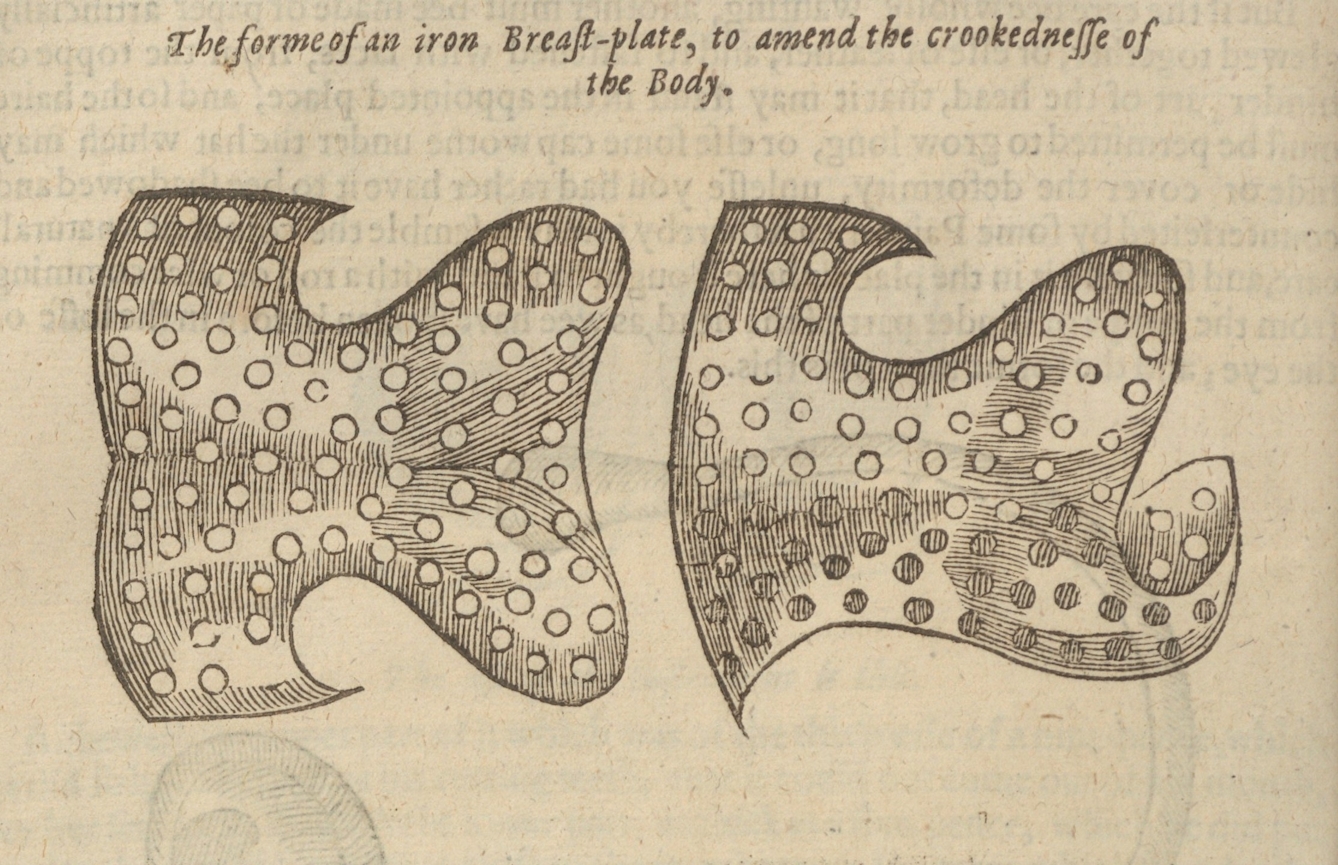 Illustration from 'The Works of Ambroise Pare' showing the two parts of a perforated iron breast plate used to correct spinal deformity