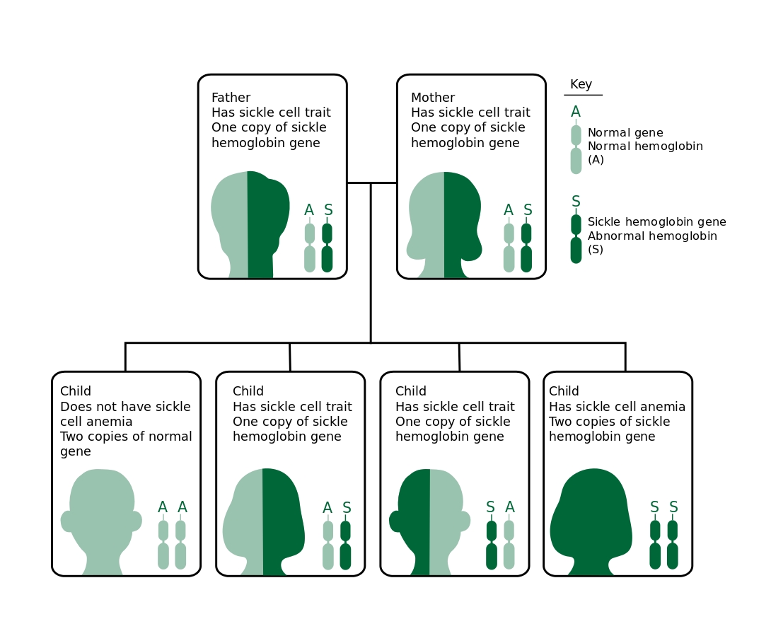 Colour image of a family tree showing the autosomal recessive pattern of inheritance in sickle cell disease by colour coding pictures of heads and genes, with dark green representing a sickle haemoglobin gene and light green representing normal haemoglobin. The two parents each have one copy of the sickle haemoglobin gene shown by heads half dark and half light. One child is entirely light green representing two copies of the normal gene. Two children are half of each, like their parents. One child is dark green, indicating that they have two copies of the sickle haemoglobin gene and therefore have sickle cell anaemia. 