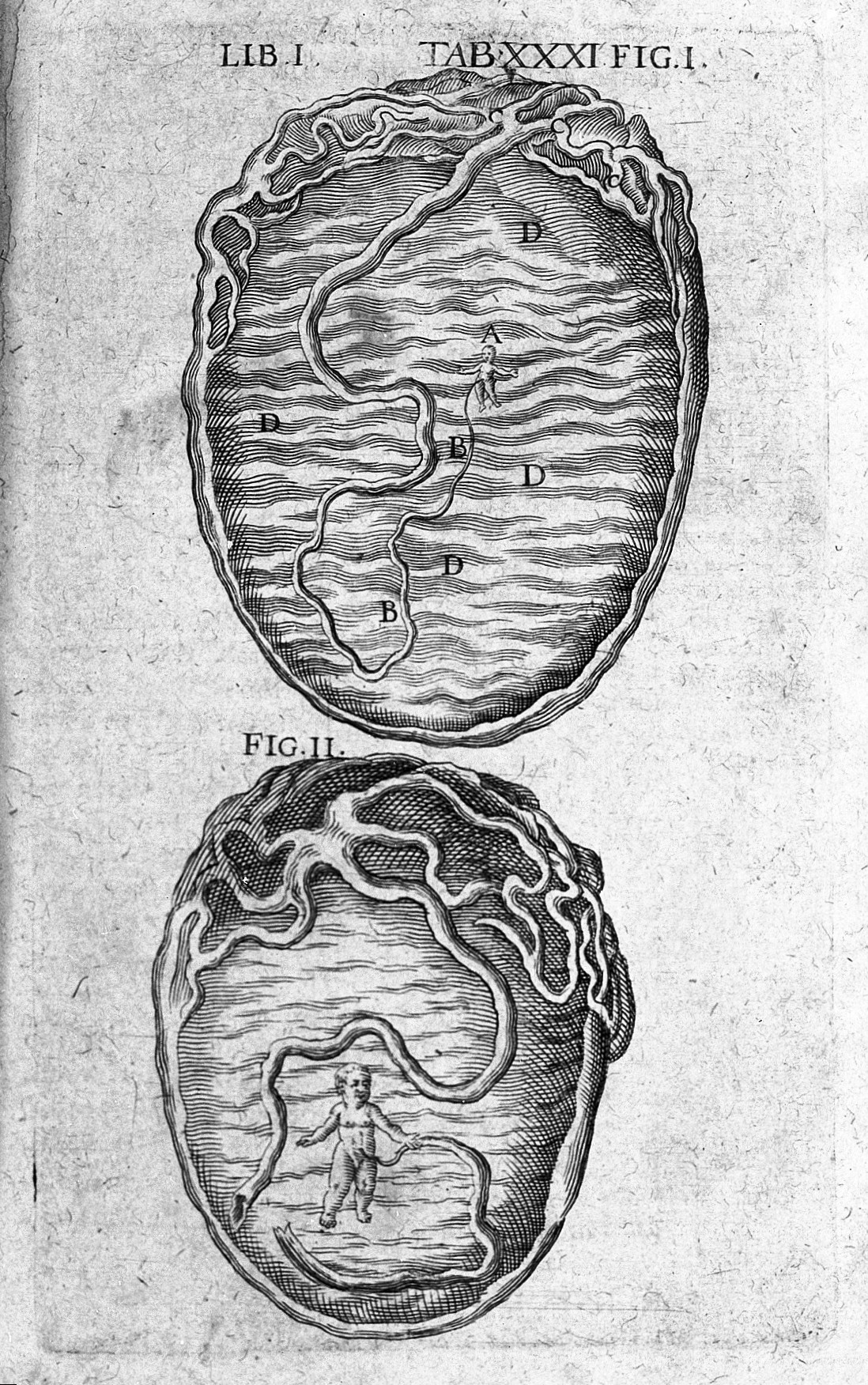 Two pictures of small foetuses inside wombs connected to long umbilical cords.