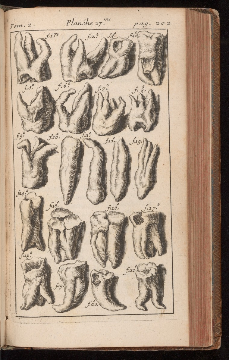 A black and white illustration featuring several molars with roots.