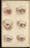 Colour engravings of eye problems such as muscles grown over eyeballs or turned inside out.