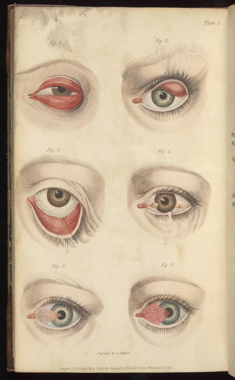 Colour engravings of eye problems such as muscles grown over eyeballs or turned inside out.