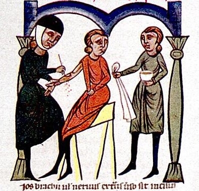 Coloured medieval drawing showing a person dressed in red pulling their sleeve aside and looking away as a person dressed in black cuts their arm with a scalpel and blood drips down. To the right, someone wearing green stands with a bowl and cloth.