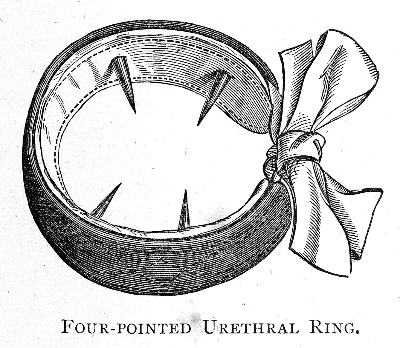 Four-pointed urethral ring for the treatment of masturbation