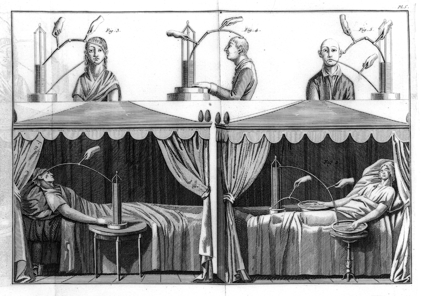 Black and white etching showing five people. On the top, against a white background, three people are shown from the shoulders up with electrical apparatus attached to them and disembodied hands operating the equipment. On the bottom, against a dark background of curtains and drapes, two recumbent corpses are attached to similar equipment positioned on a table beside their beds, also with disembodied hands operating it. 