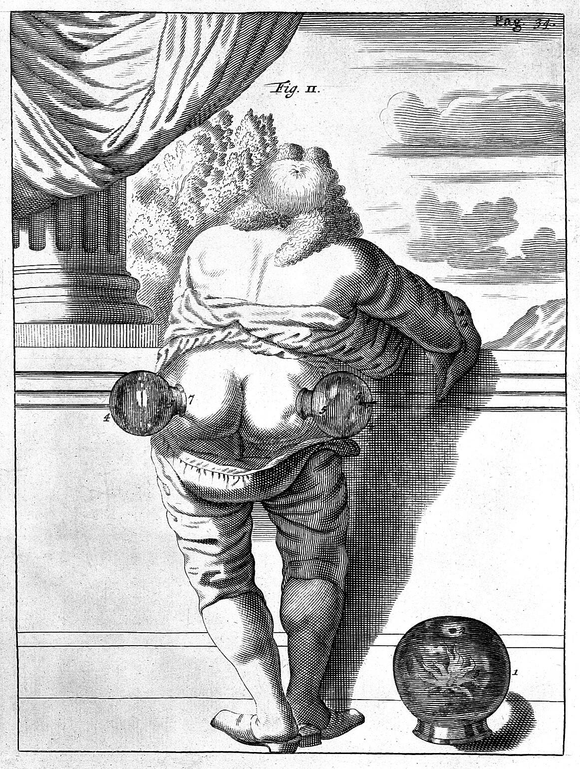 Black and white engraving showing the rear of a man who has his breeches pulled down and a cupping cup prominently fastened to each buttock. In the background are classical details such as a column and drape.