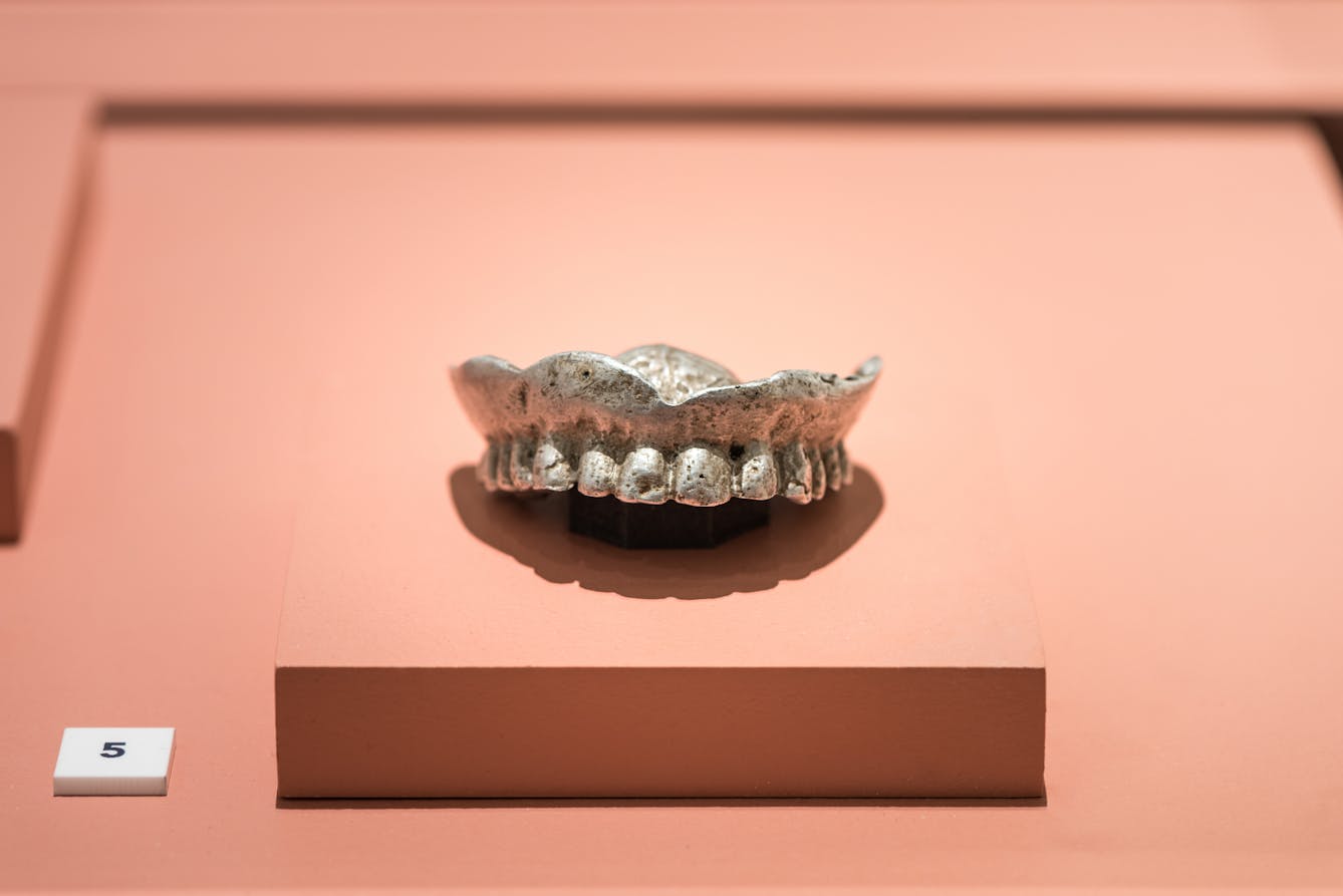 Photograph of an upper set of aluminium dentures in an exhibition case.