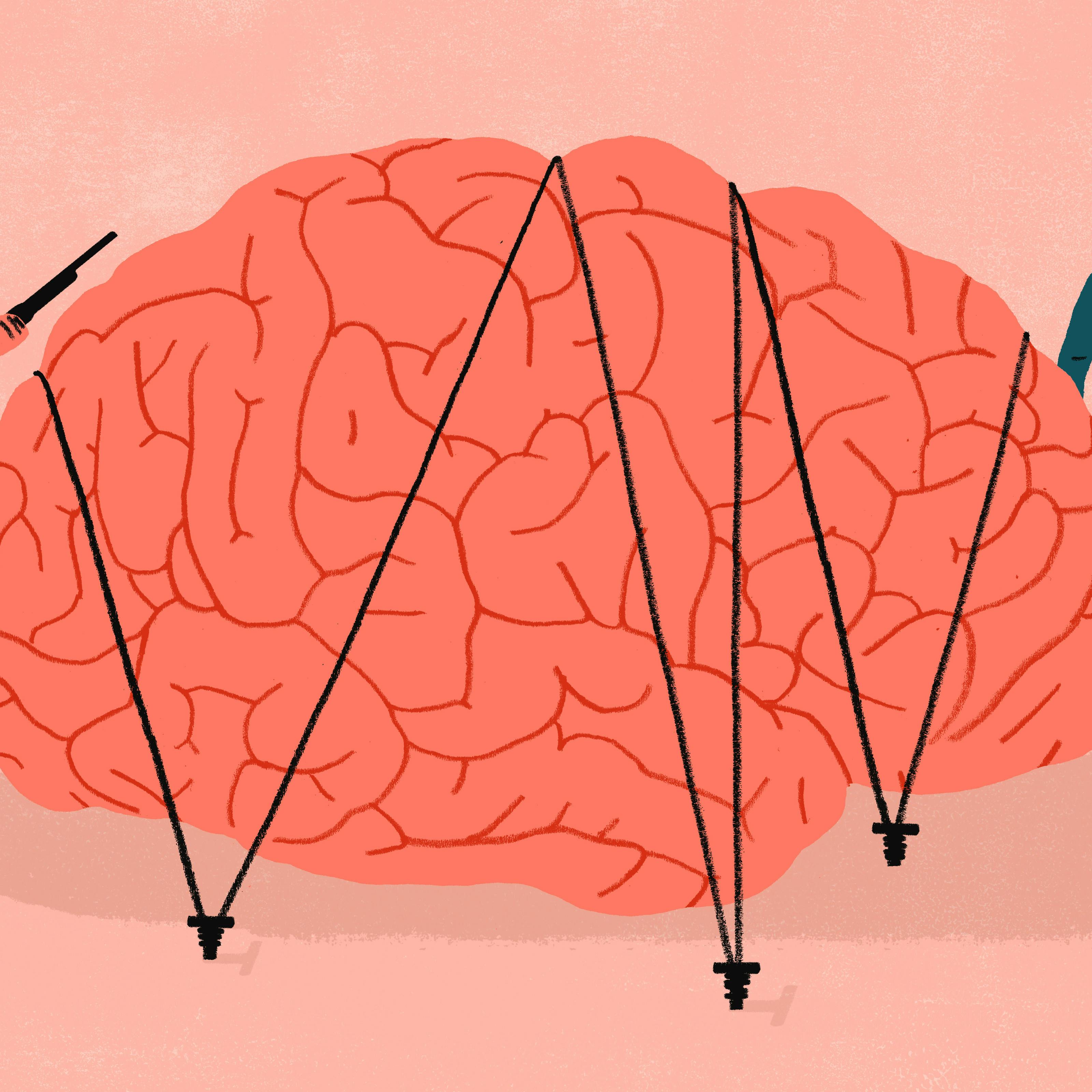 Four armed guerrillas guard a giant brain held in place with bungees.