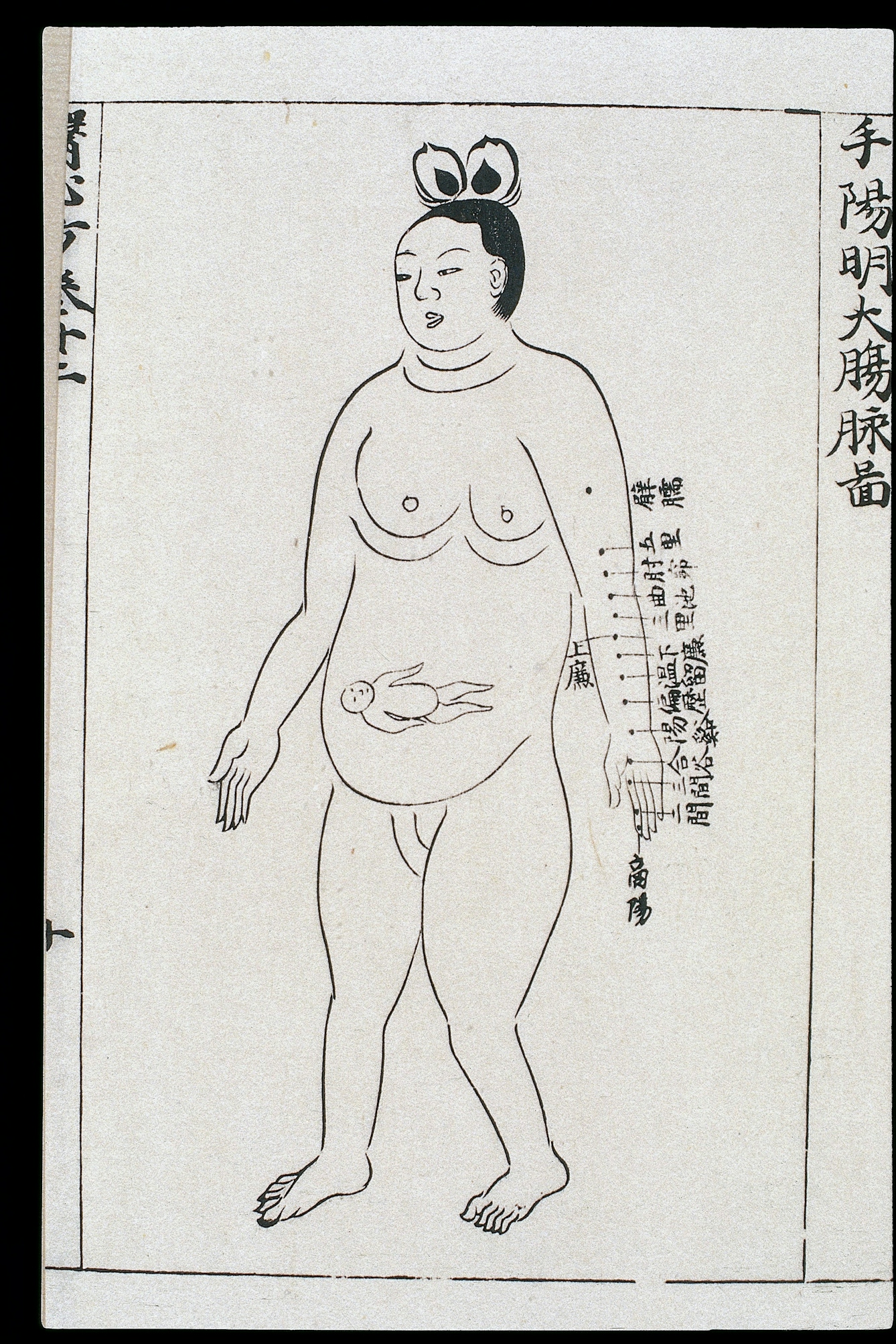 Chart showing locations on the Large Intestine channel of arm yangming where acupuncture is prohibited during the eighth month of pregnancy, from Ishinpo [Chinese: Yi xin fang] (Remedies at the Heart of Medicine), by the Japanese author Yasuyori Tanba.