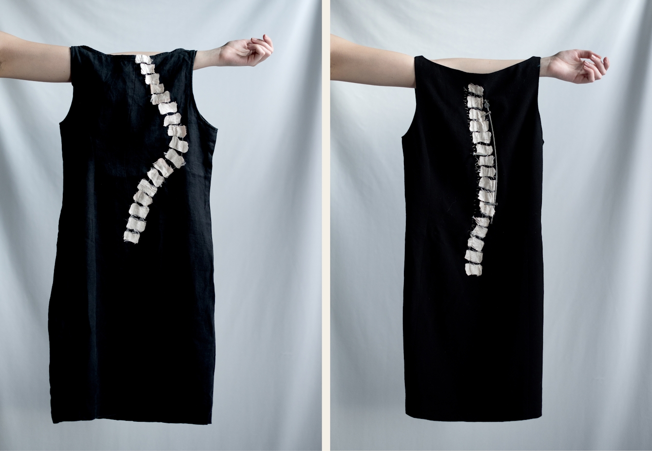 Photographic diptych. Both images show an arm held out horizontally, appearing into the frame from the left. Hung off each arm is a black dress. The image on the left has the white vertebrae of a spine stitched into the black cloth in curved shape representative of the condition, scoliosis. The image on the right has the white vertebrae of a spine stitched into the black cloth in a straight, near vertical line.