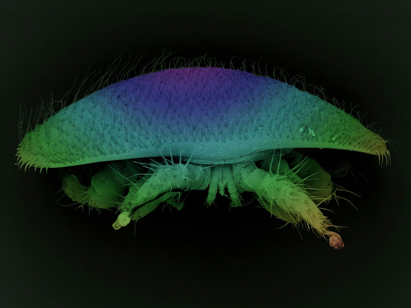 False-coloured scanning electron micrograph of a varroa parasitic mite. The creature has a shell, like a wide mushroom cap, covered in small errect hairs or spines. Beneath this, two legs protrude also covered in spiny hairs.