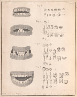 The secrets your teeth hold | Wellcome Collection