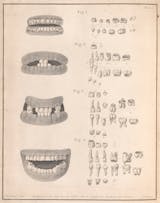 The secrets your teeth hold | Wellcome Collection