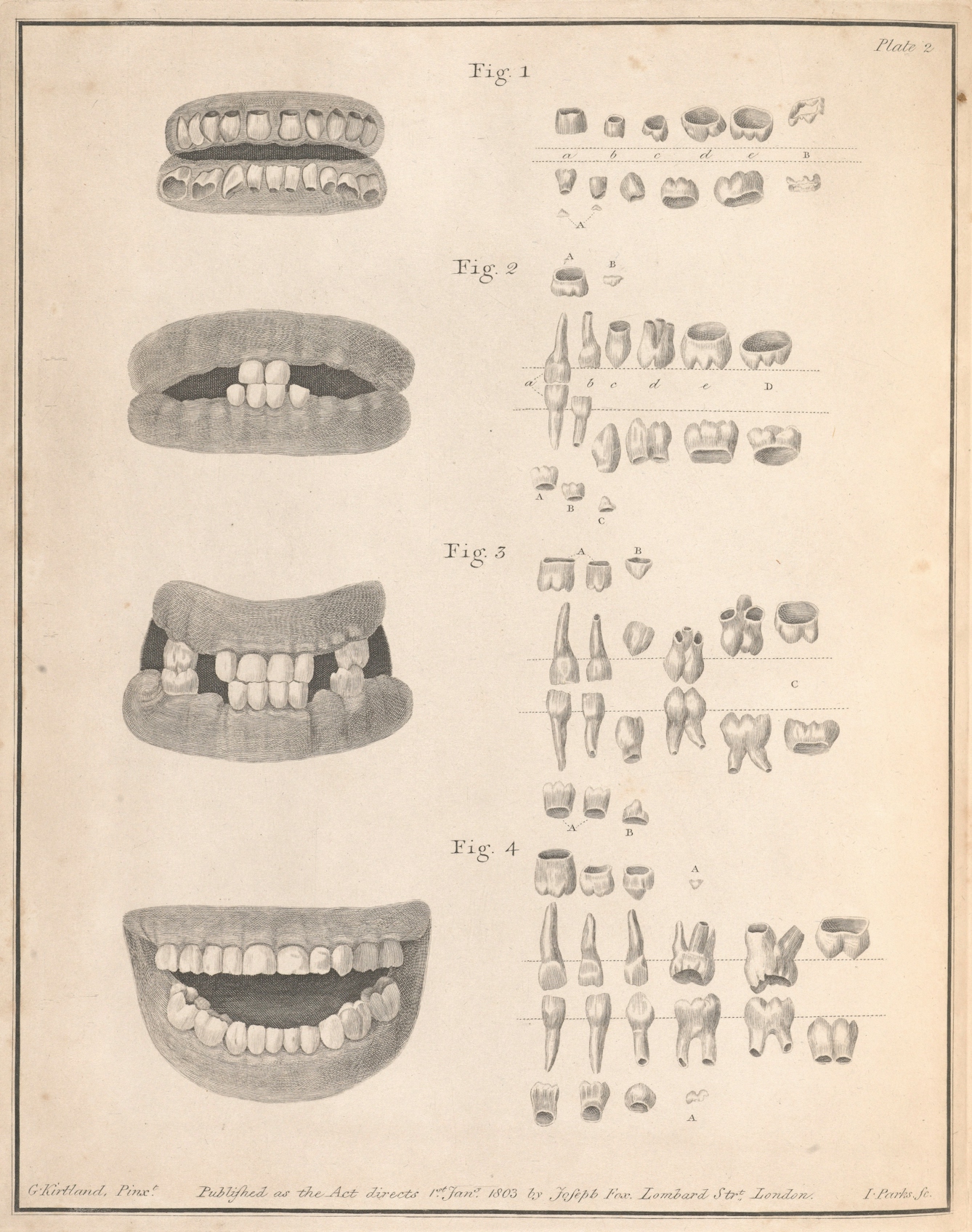 Copper-plate etching showing human teeth at four different ages.