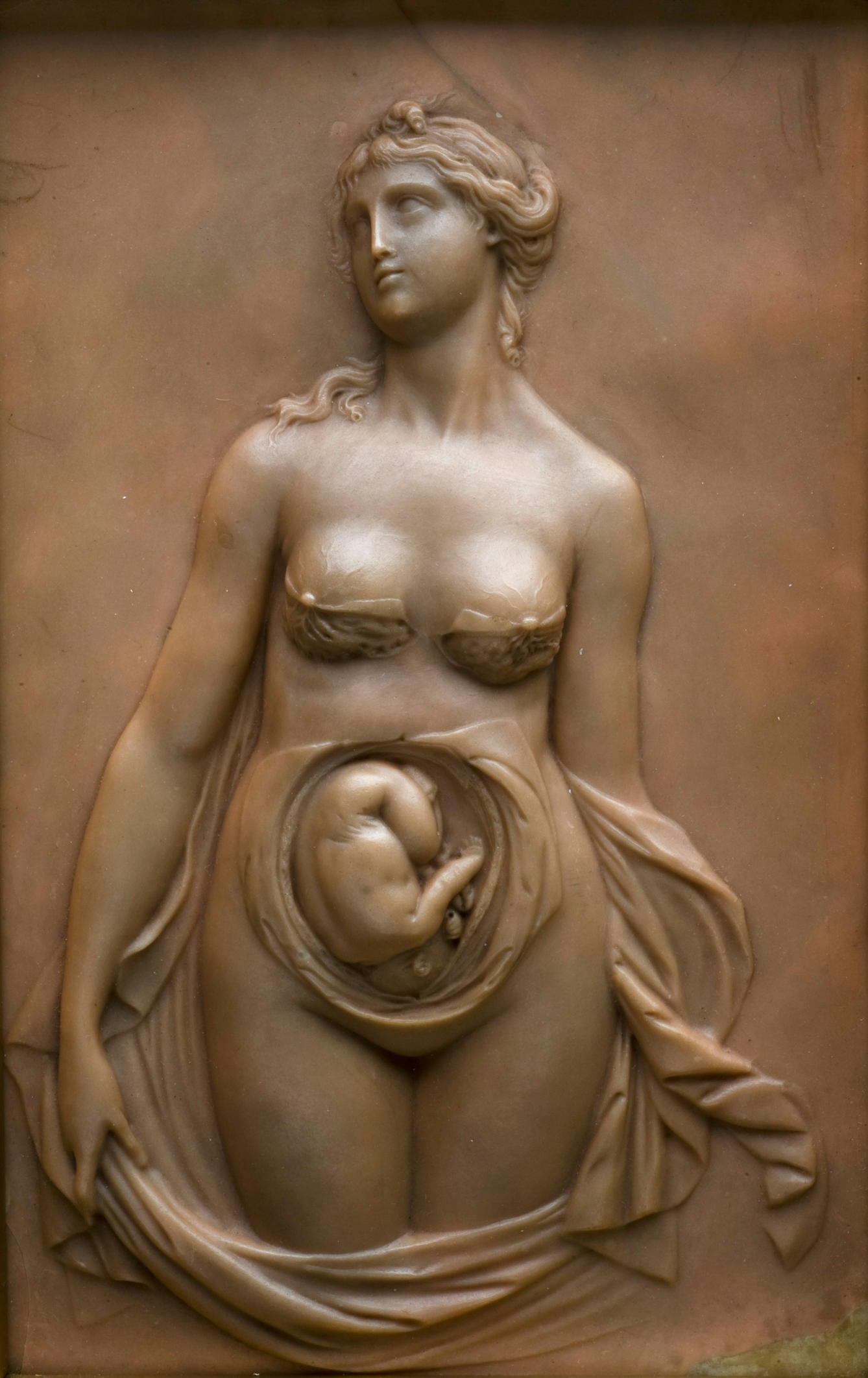Female figure with part of skin and wall of uterus removed to show foetus in utero.