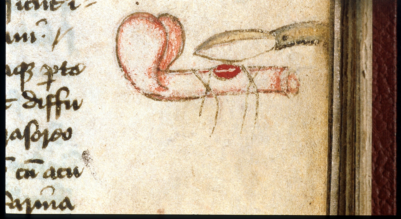 Colour image from a medieval manuscript showing a marginal drawing of a diseased penis and a scalpel.