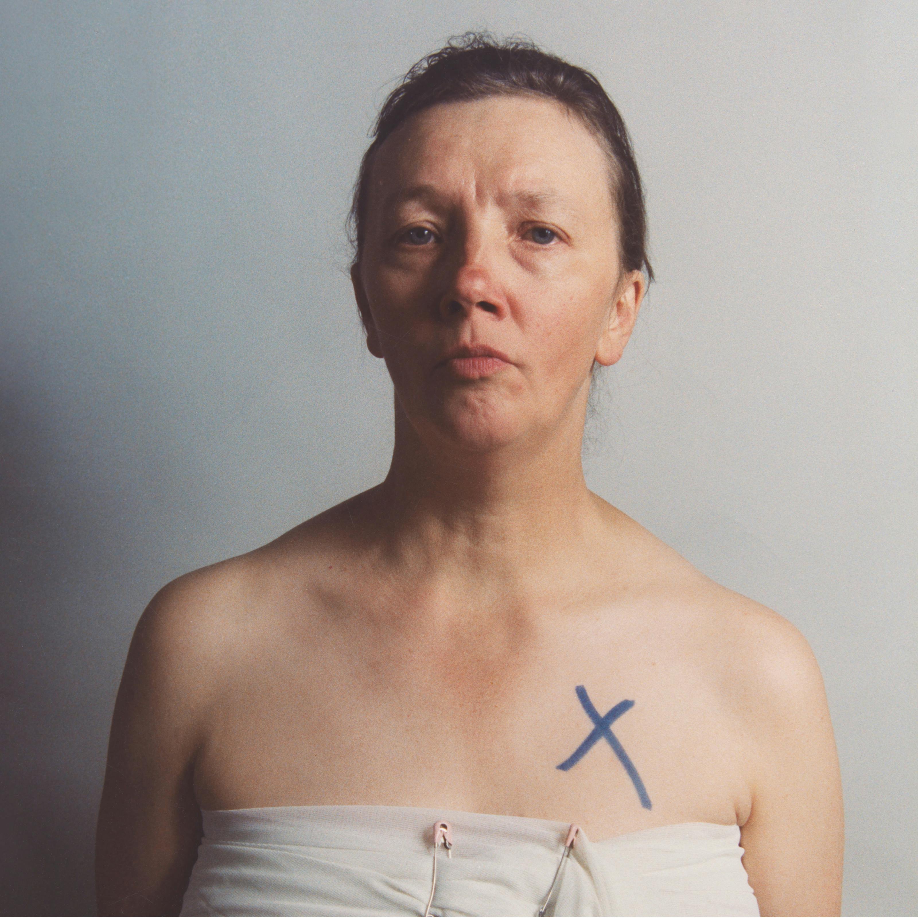 Half-body self-portrait of Jo Spence, with her chest wrapped in white muslin secured with two nappy pins and a cross in blue marker pen on skin above her left breast.