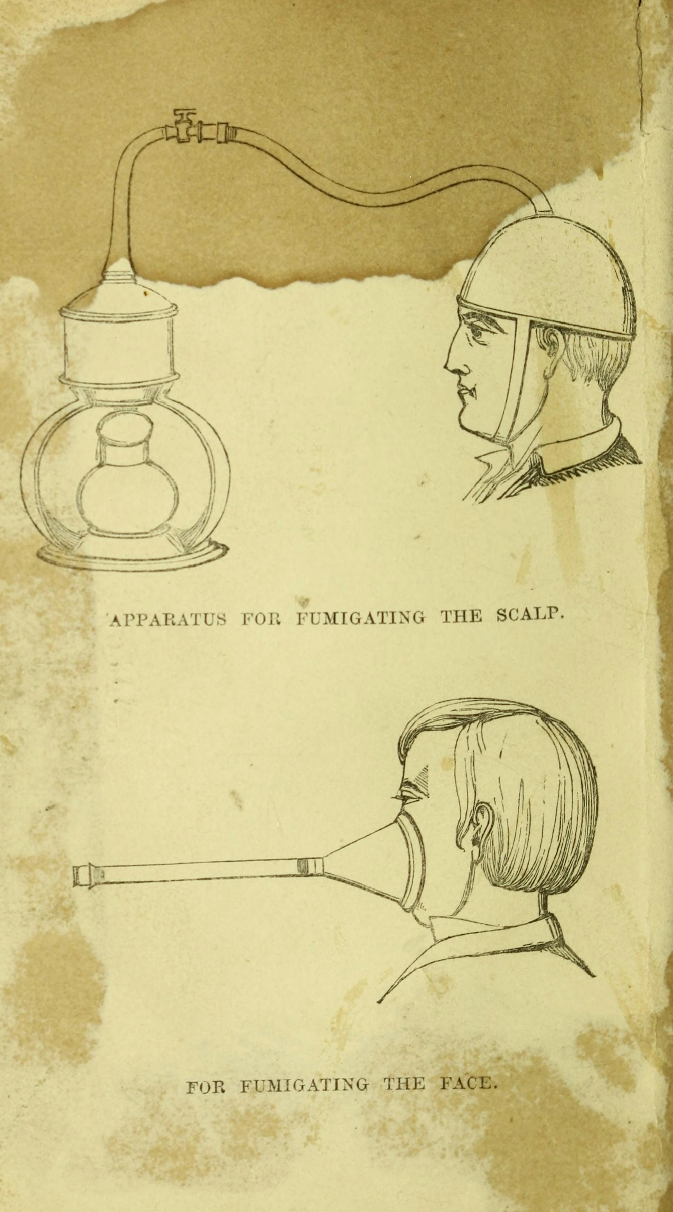 Two monochrome illustrations.  One is labelled 'Apparatus for fumigating the scalp', and shows a gas-lamp shaped apparatus attached with a hose to a cap with chinstrap which covers the head of a man in profile.  The illustration below is labelled 'For fumigating the face', and shows a tube attached to a cone which covers the nose and mouth of a person in profile.