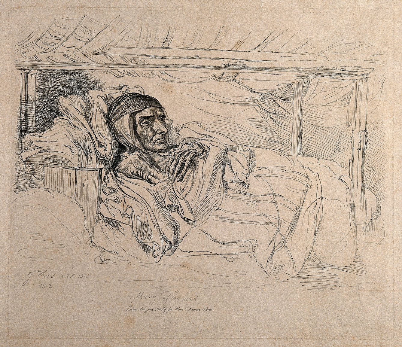 Black and white etching showing a thin woman lying in bed.