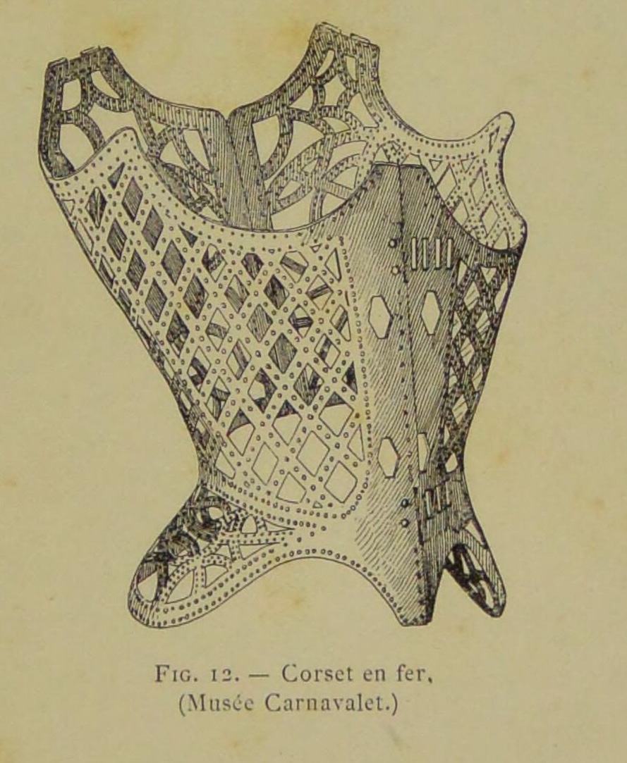 Illustration of the iron corset held by the Musee Carnavalet, Paris.