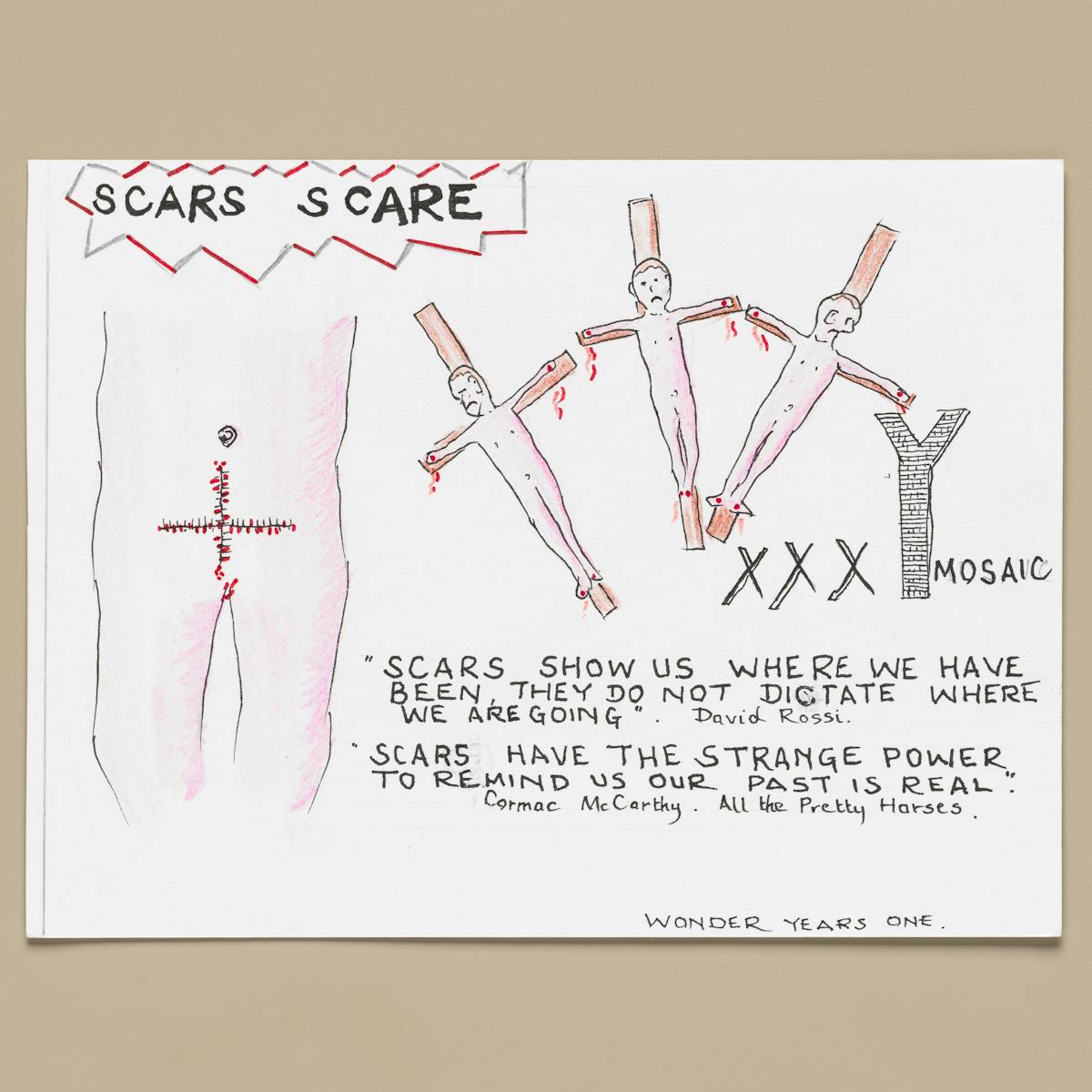 Photograph of an artwork resting on a light taupe coloured background. The artwork is colour pencil and ink on textured white paper. It it titled 'scars scare' set within a jagged red accented frame. Underneath is the drawing of a naked torso with a cross shaped wound stitched closed across the body's lower abdomen.To the right are 3 more naked figures, each attached to a crucifix. Below are the letters XXXY Mosaic and the words 'Scars show us where we have been they do not dictate where we are going. David Rossi' and 'Scars have the strange power to remind us our past is real. Cormac McCarthy, All the Pretty Horses'.