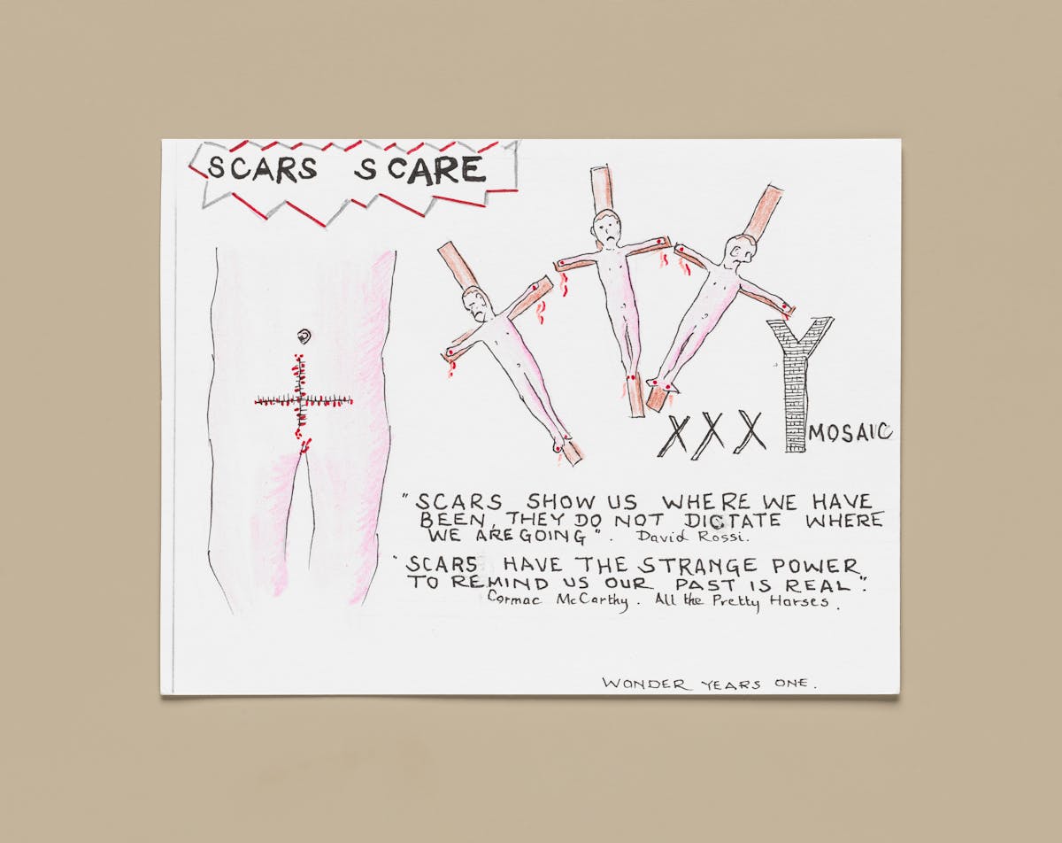 Photograph of an artwork resting on a light taupe coloured background. The artwork is colour pencil and ink on textured white paper. It it titled 'scars scare' set within a jagged red accented frame. Underneath is the drawing of a naked torso with a cross shaped wound stitched closed across the body's lower abdomen.To the right are 3 more naked figures, each attached to a crucifix. Below are the letters XXXY Mosaic and the words 'Scars show us where we have been they do not dictate where we are going. David Rossi' and 'Scars have the strange power to remind us our past is real. Cormac McCarthy, All the Pretty Horses'.