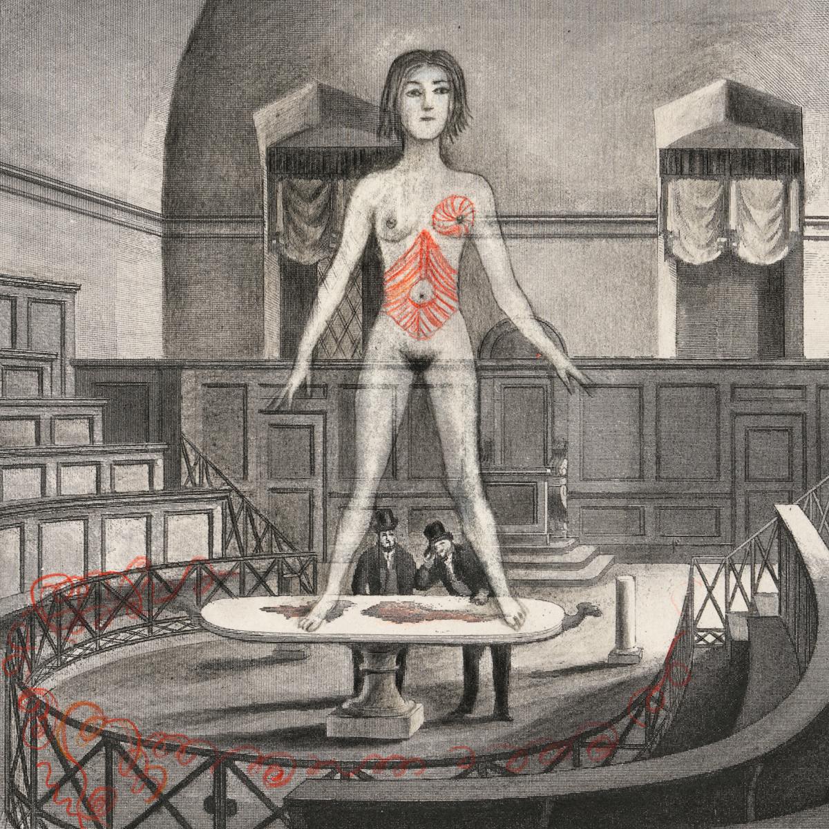 Pencil artwork drawn over an engraving depicting an old anatomy theatre with two men in the centre, by a table looking up towards a large (in scale) unclothed woman standing on the table, arms held away from her body. The whole scene is black and white apart from her torso and left breast, and thin cords woven into some railings which are tinted red.