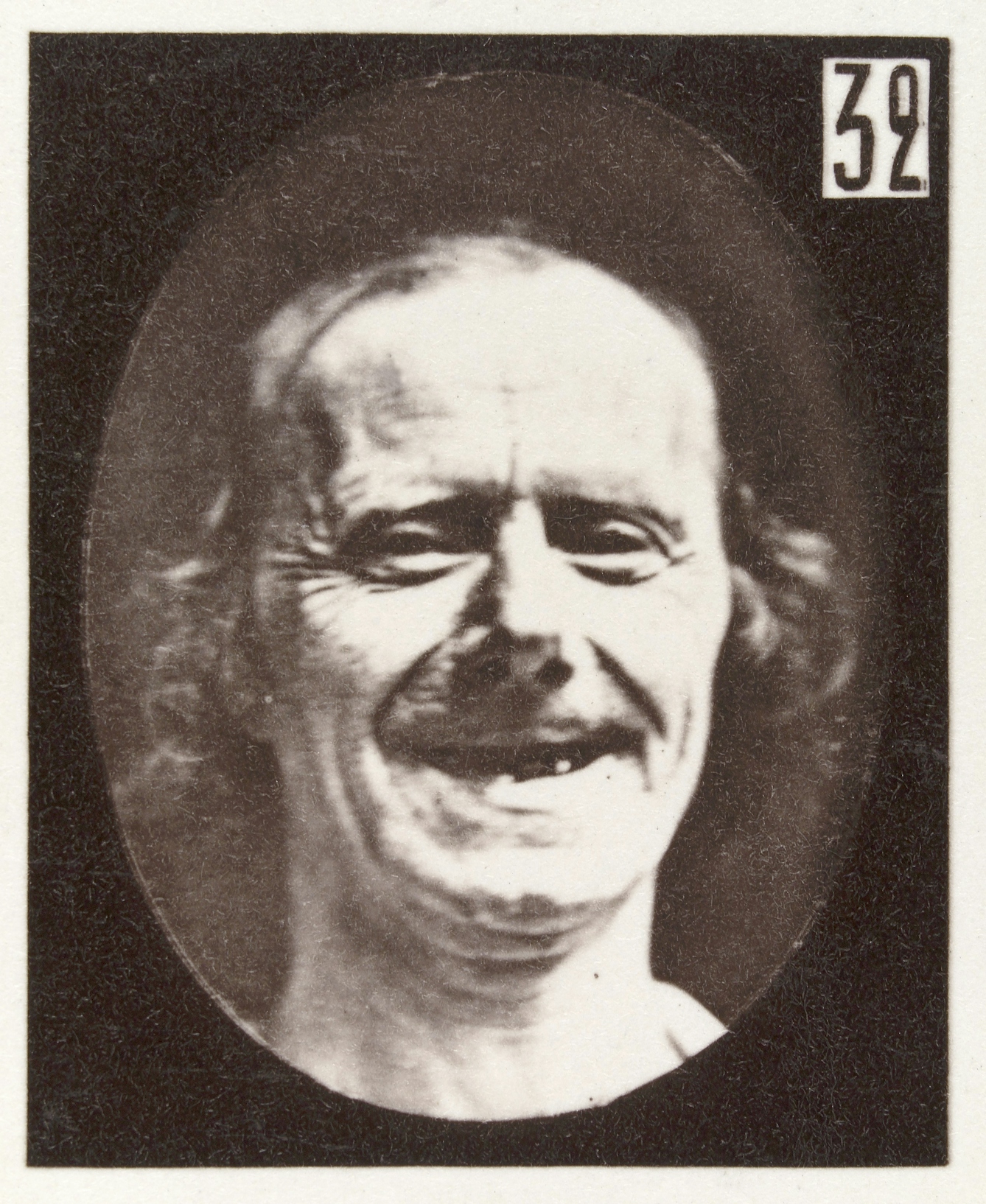 Photograph of a man's face showing natural laughter