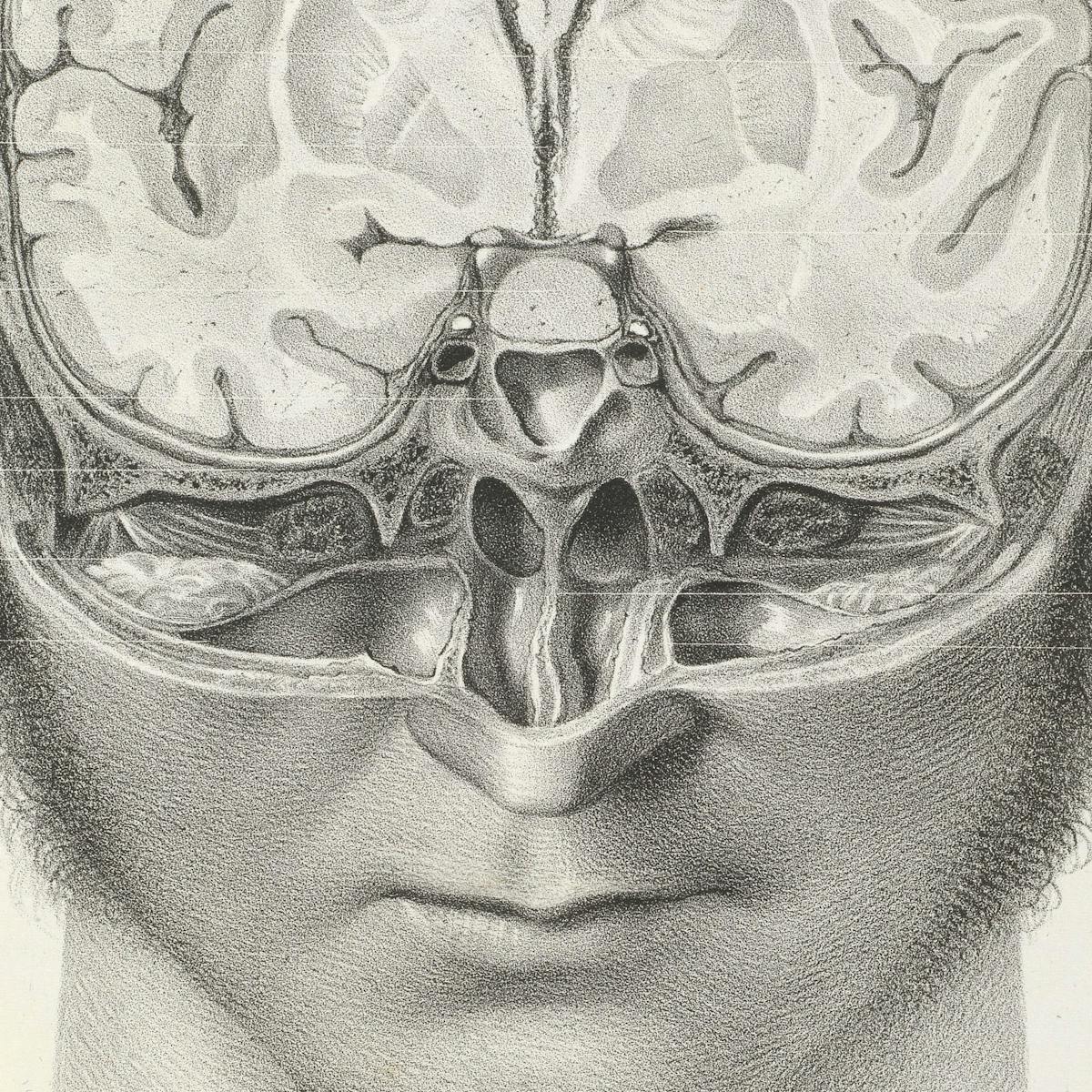 Black and white image showing a man’s head with part of it cut away to reveal the brain inside.