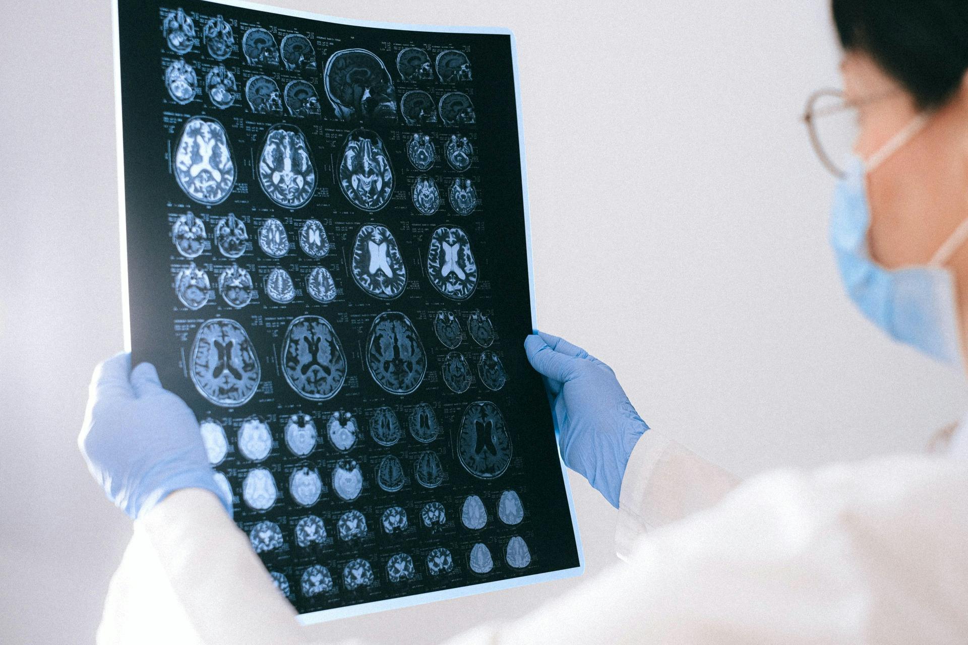 Doctor checking brain scan image