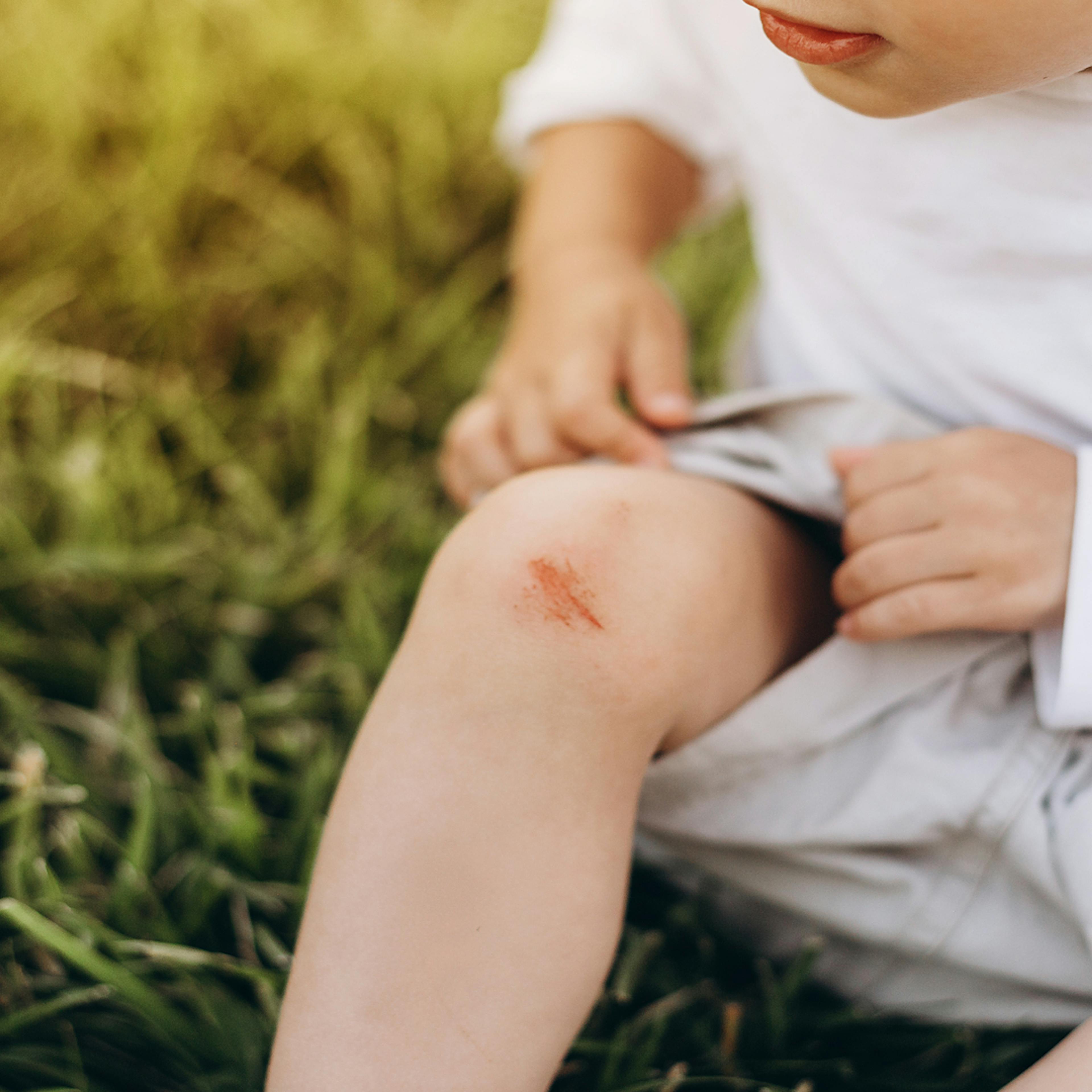 La importancia de cuidar tus heridas