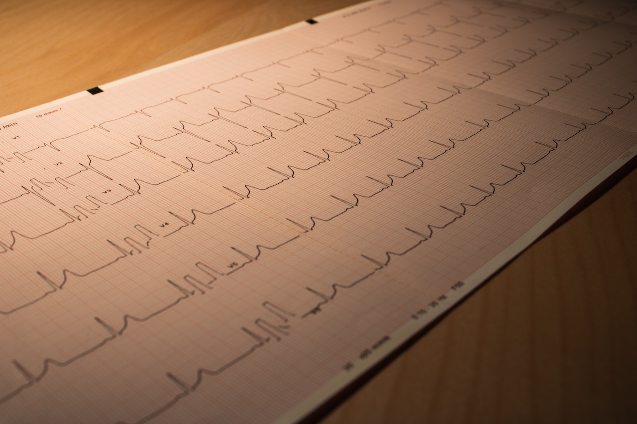 Diagnose von Herzrhythmusstörungen
