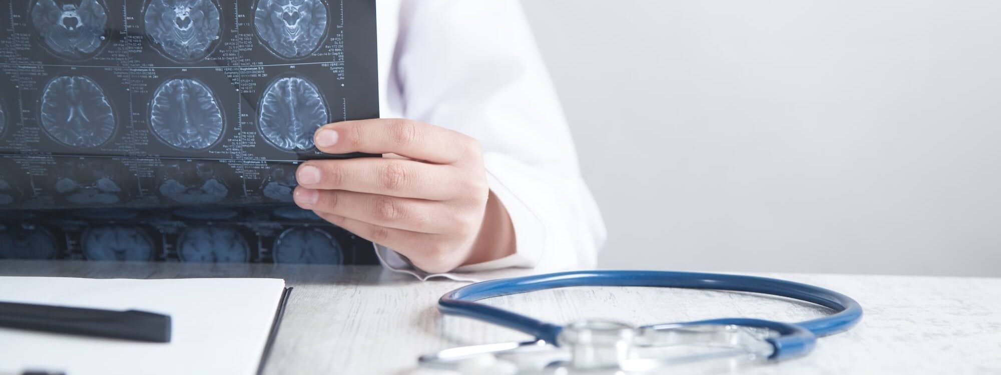 Arzt in der Neurologie schaut auf MRT-Aufnahmen des Gehirns
