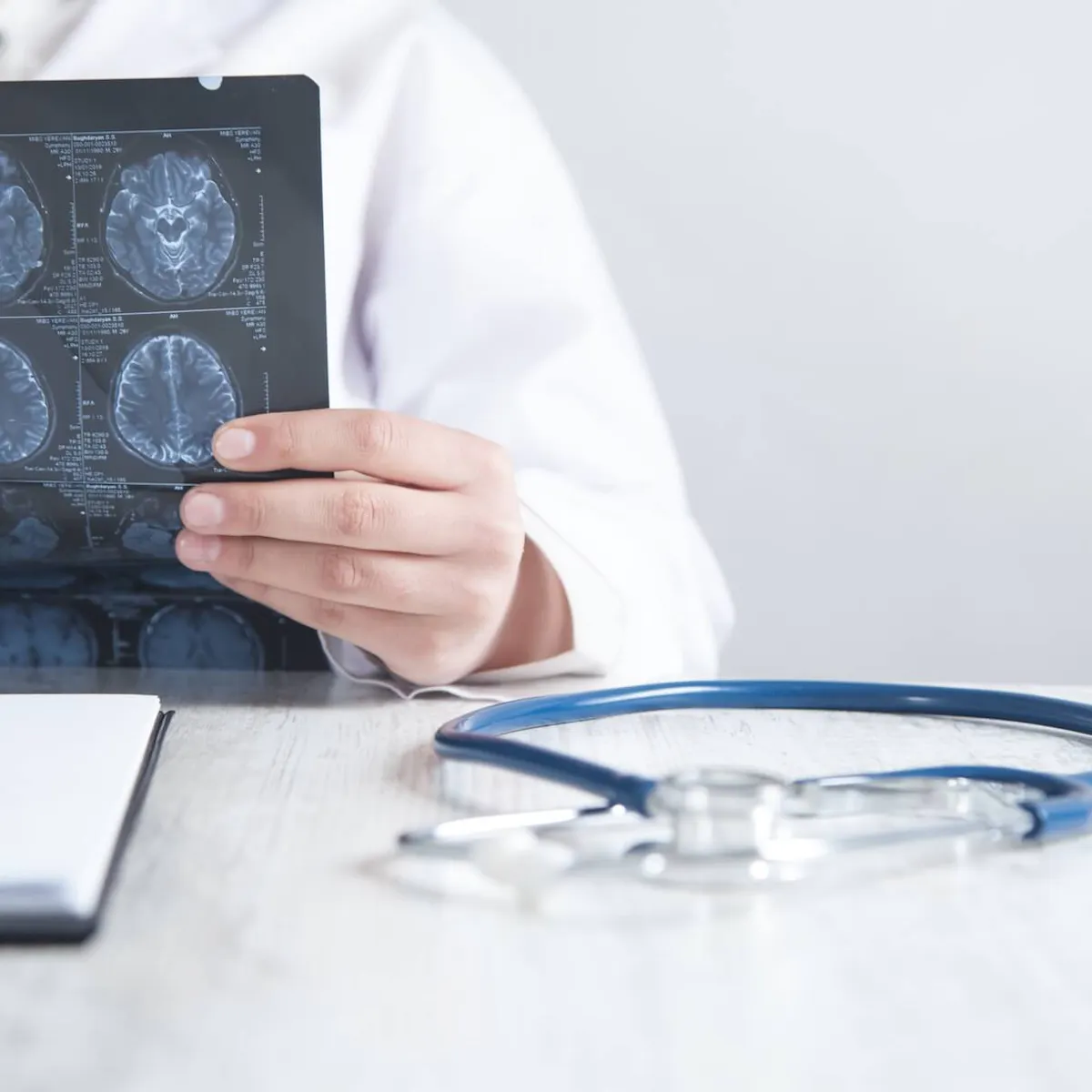 Arzt schaut sich ein Röntgenbild an