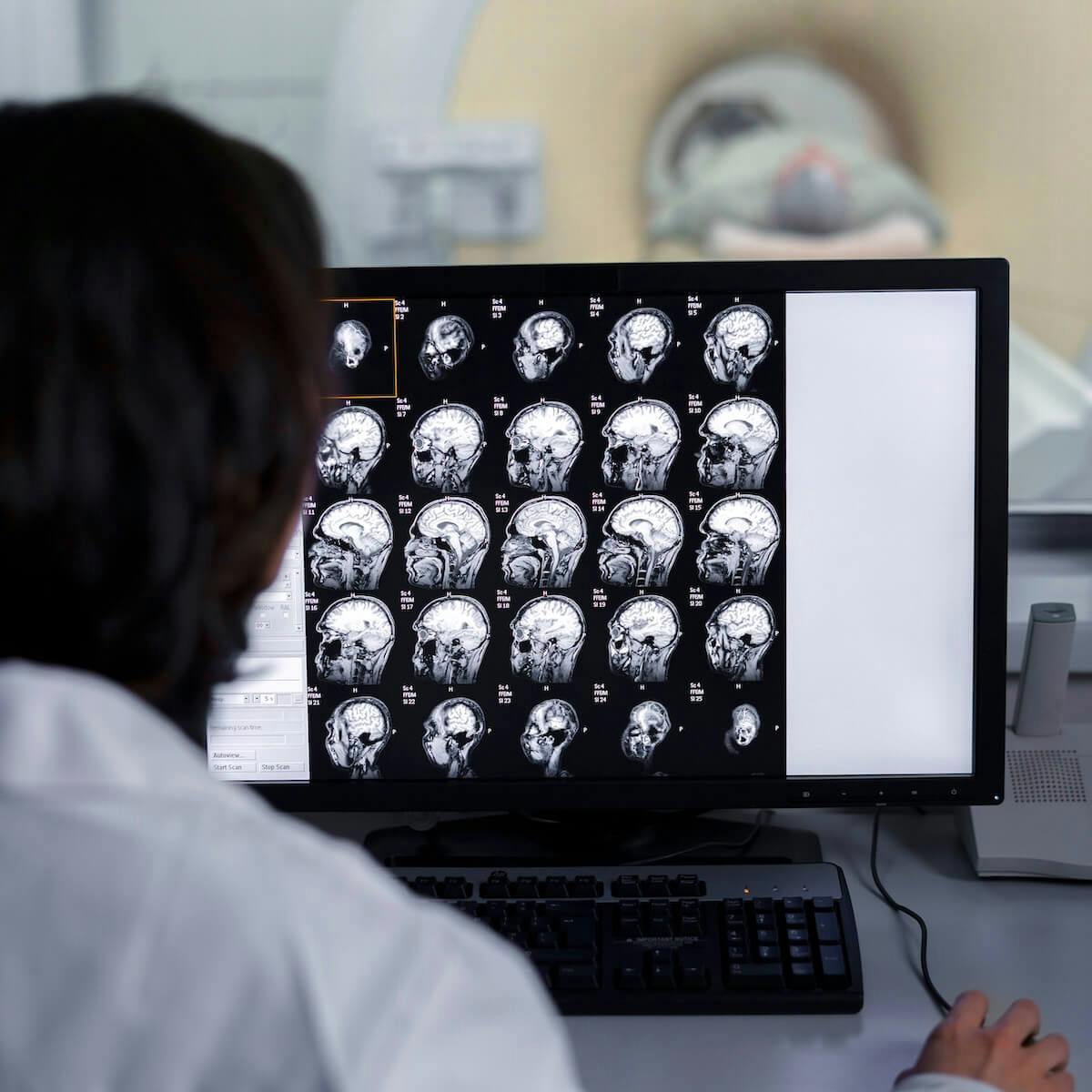 Arzt schaut auf Ergebnisse des MRT