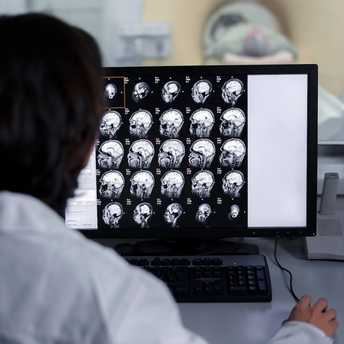 MRT von einem Gehirn in der Radiologie des MVZ an der Werner Wicker Klinik MRT von einem Gehirn in der Radiologie des MVZ an der Werner Wicker Klinik