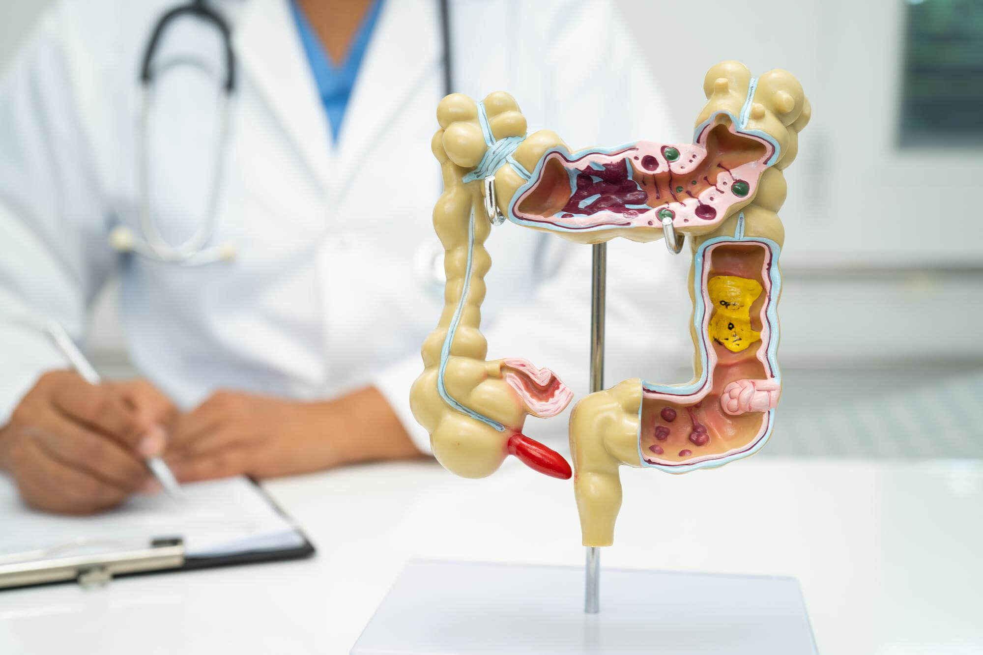 Anatomisches Modell des Dickdarms vor einem Arzt